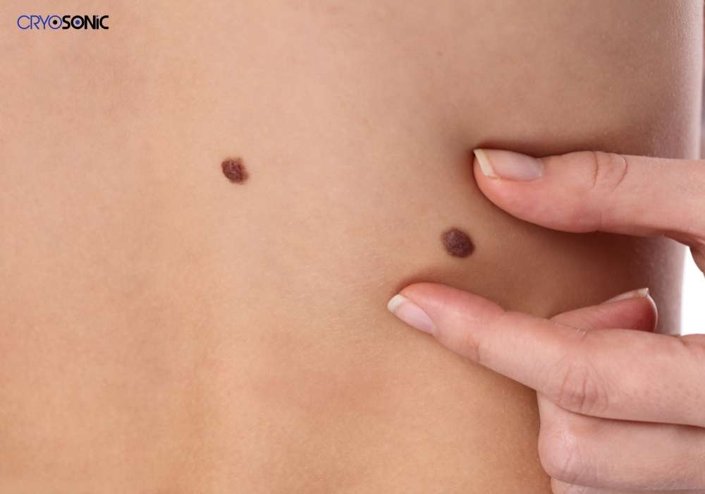 Infection Risk and Poor Aftercare Henley on Thames