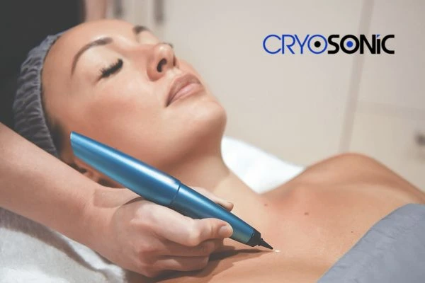 Cryosonic lesion removal prices book today! Henley on Thames