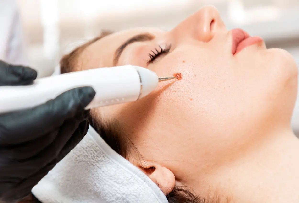Frequently Asked Questions About Multiple Cryotherapy Treatments Henley on Thames