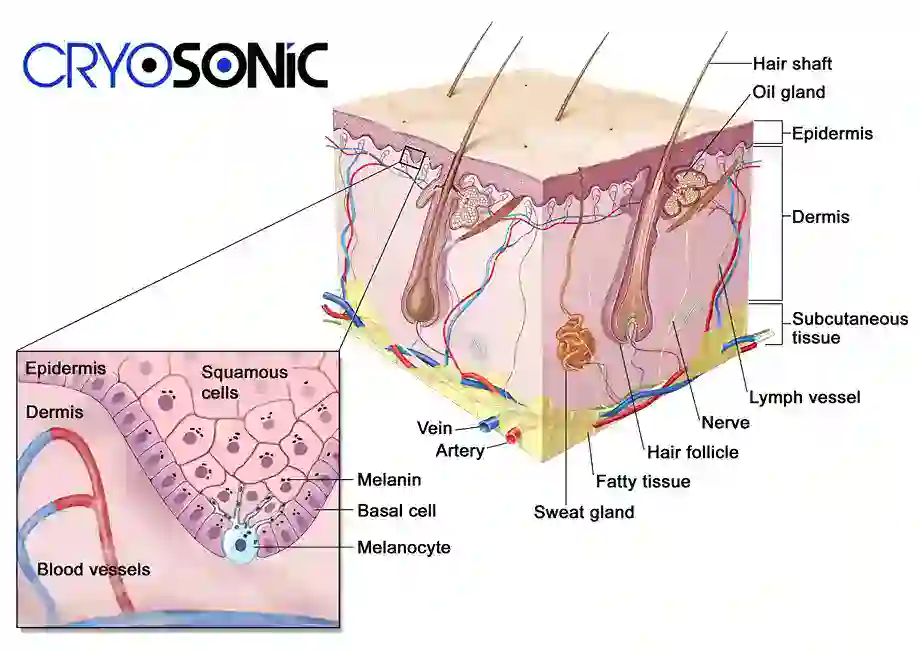 How Cryotherapy Stimulates Melanocyte Activity  Henley on Thames